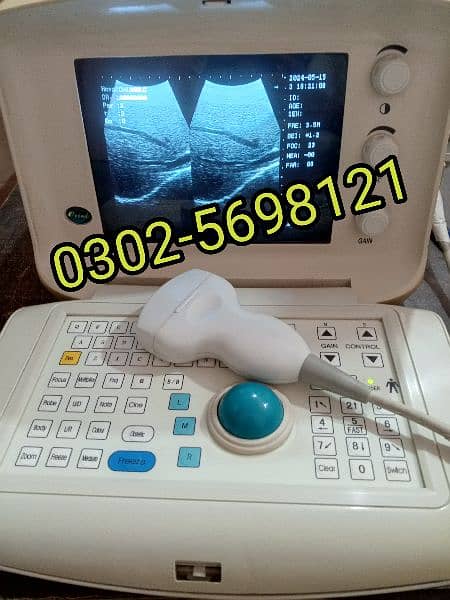 portable ultrasound machine avaiblae, Contact; 0302-5698121 3