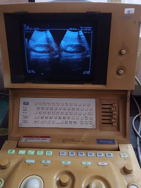 portable ultrasound machine avaiblae, Contact; 0302-5698121 14