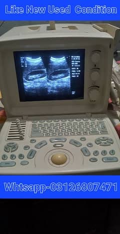 Ultrasound machine Like New Used condition Sale  Whtsap-03126807471