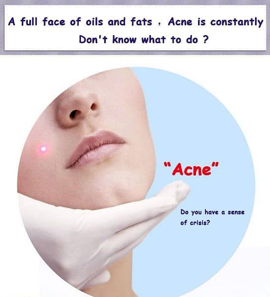 Anti Acne Serum 2