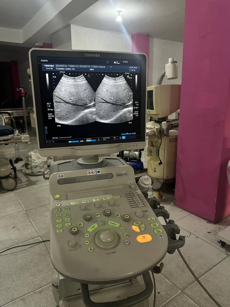 Ultrasound Machines Doppler & Gray Scales - Importer rates 8