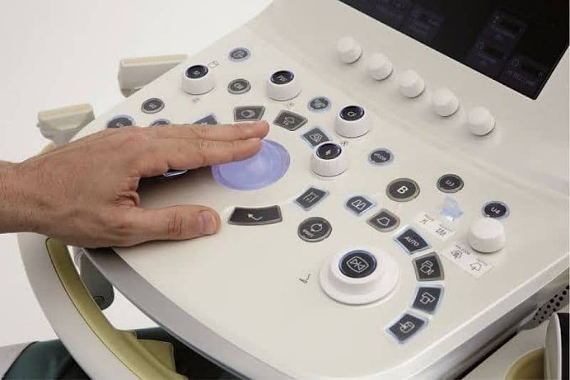 Ultrasound Machine Aloka Arietta 60 1