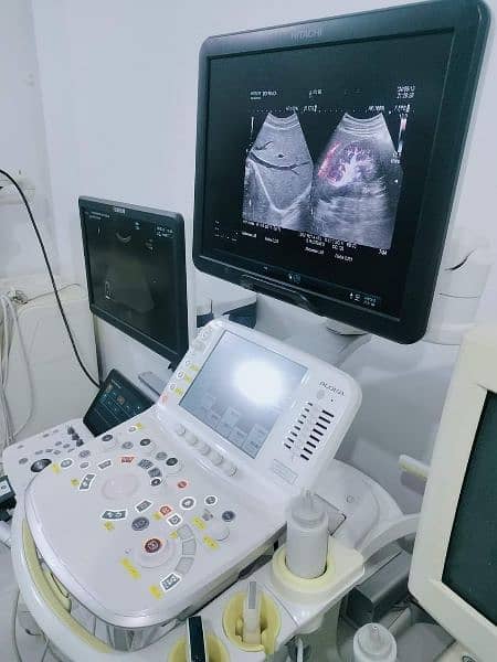 Ultrasound Machine Top of the line Hitachi Arrita 70 available 2