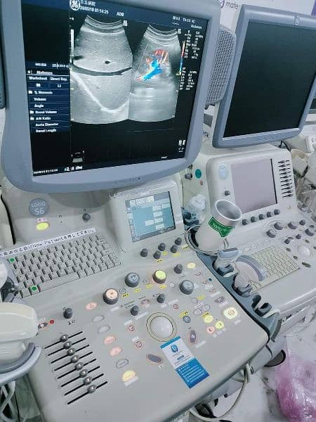 Ultrasound Machine and Color Doppler Japani LCD based available 4