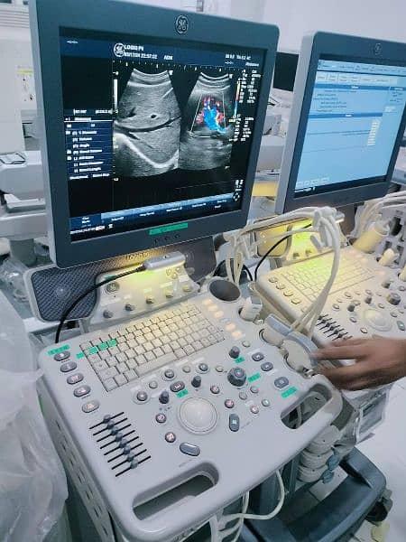 Ultrasound and Color Doppler GE Logiq P6 with 4D configurations 4
