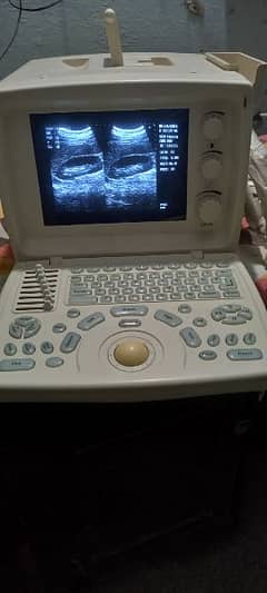 Ultrasound machine Like New condition Sale Whtsap-03126807471