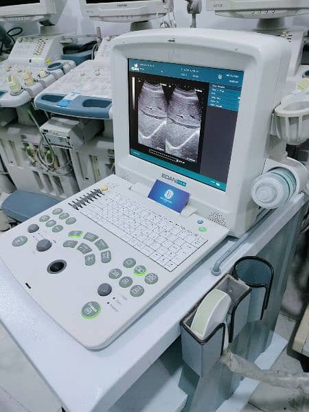 Ultrasound Machine DUS 60 with battery backup and pw Doppler 1
