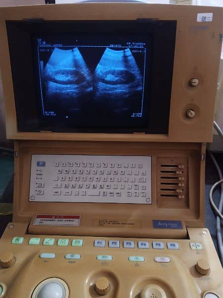 Toshiba ultrasound machine for sale, Contact; 0302-5698121 19