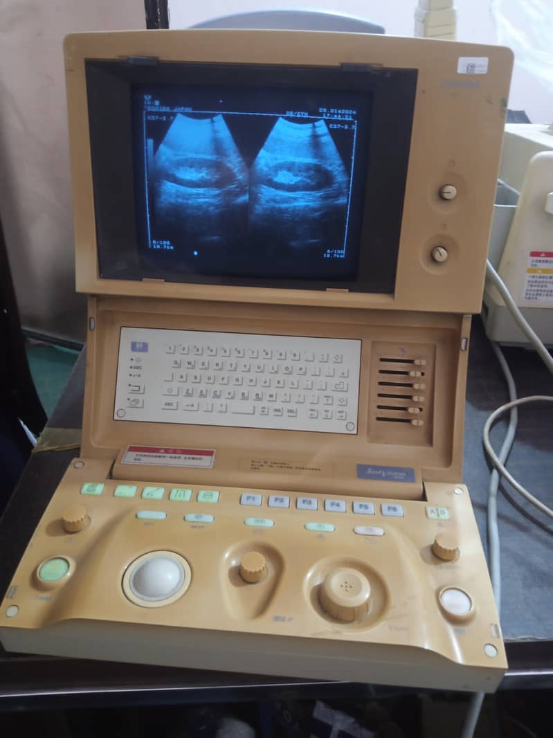 japanese Gray scale ultrasound machine for sale 1
