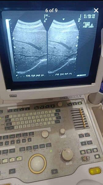 japanese Gray scale ultrasound machine for sale 5