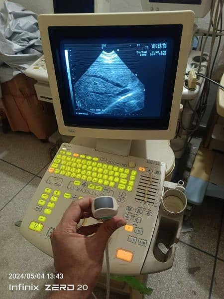 japanese Gray scale ultrasound machine for sale 7