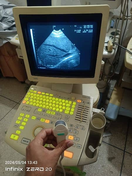 japanese Gray scale ultrasound machine for sale 9