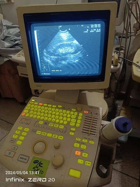 japanese Gray scale ultrasound machine for sale 11