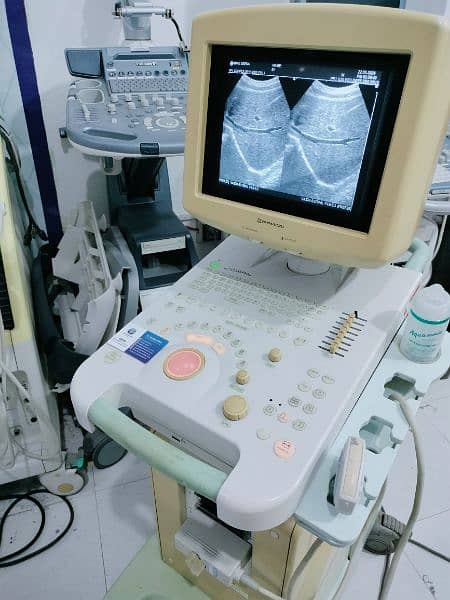 Shumadzu Gray Scale Ultrasound Machine 1