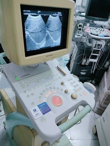 Shumadzu Japan Ultrasound Machine available in ready stock 1