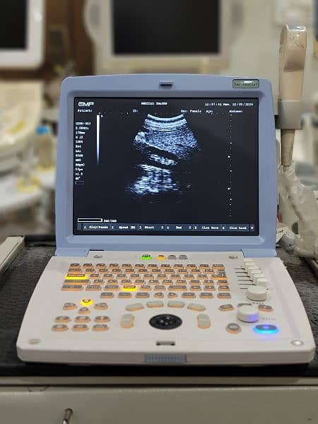 Ultrasound Machine Emp 820 plus 1