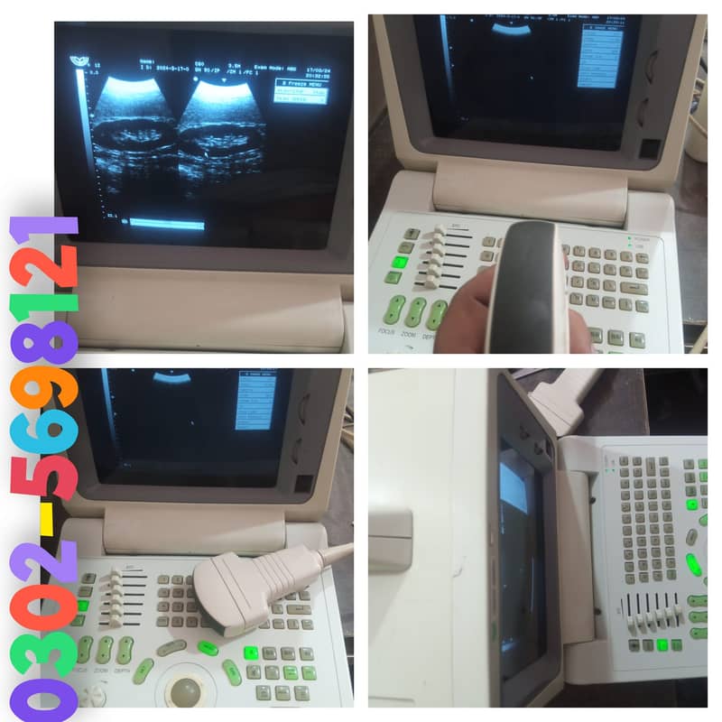 portable ultrasound machine for sale, contact; 0302-5698121 16