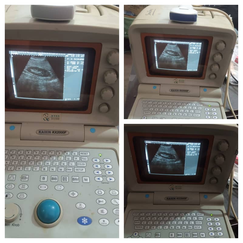 portable ultrasound machine avalible in stock 2