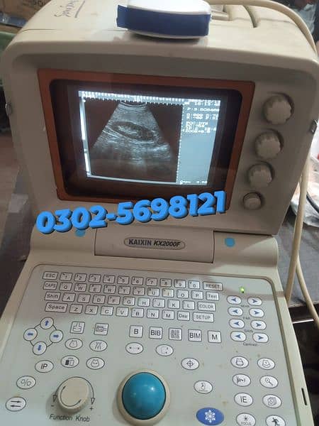 portable ultrasound machine avalible in stock 5