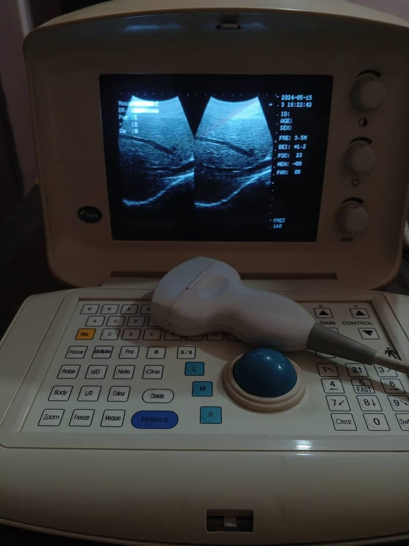 portable ultrasound machine avalible in stock 6