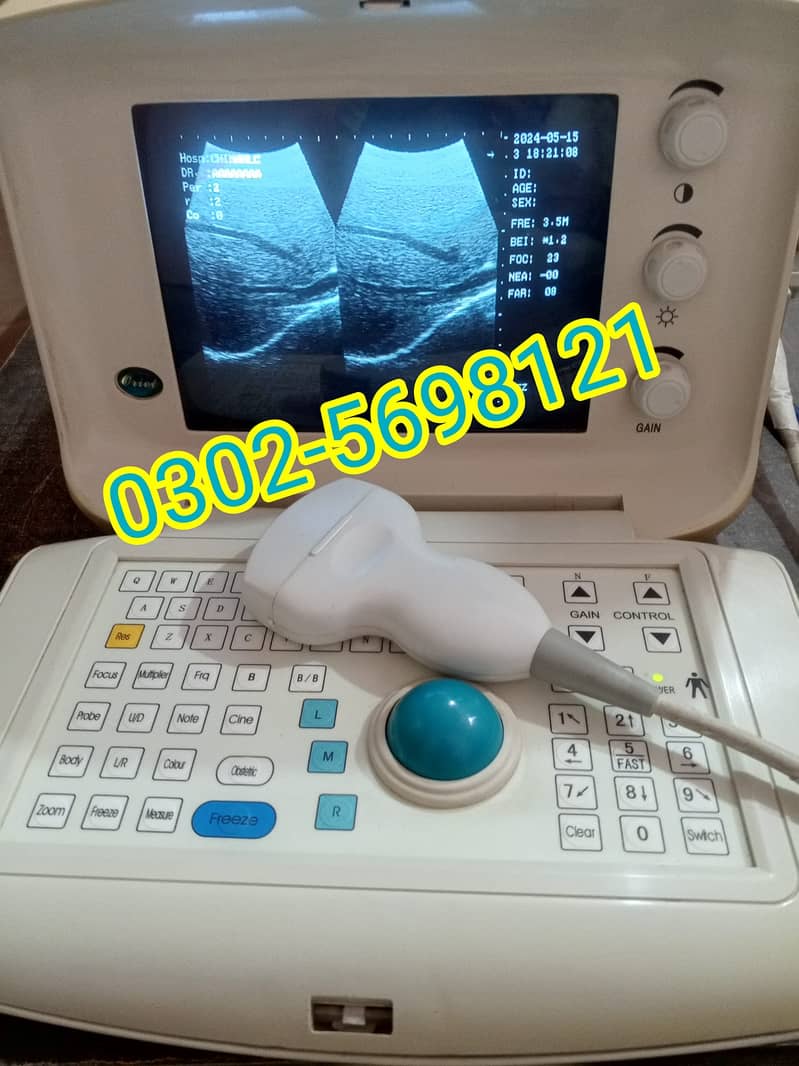 portable ultrasound machine avalible in stock 7