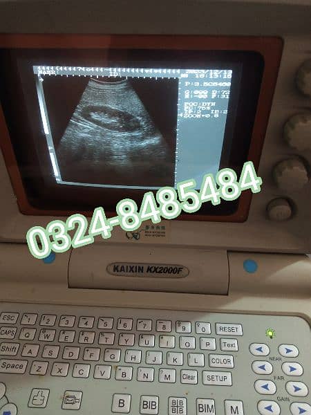 Refurbished Color Doppler available, Contact; 0302-5698121 9