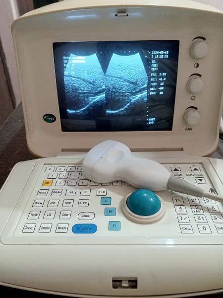 portable ultrasound machine available in stock, Contact; 0302-5698121 3