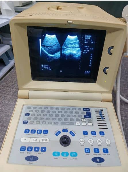 portable ultrasound machine available in stock, Contact; 0302-5698121 13