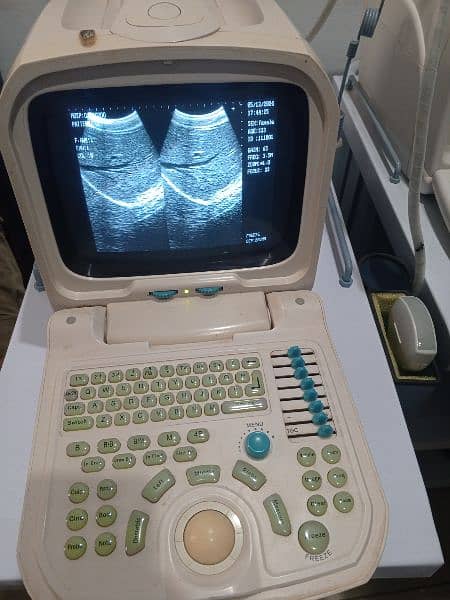 portable ultrasound machine available, Contact; 0302-5698121 5