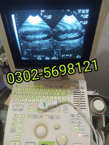 portable ultrasound machine available, Contact; 0302-5698121 9