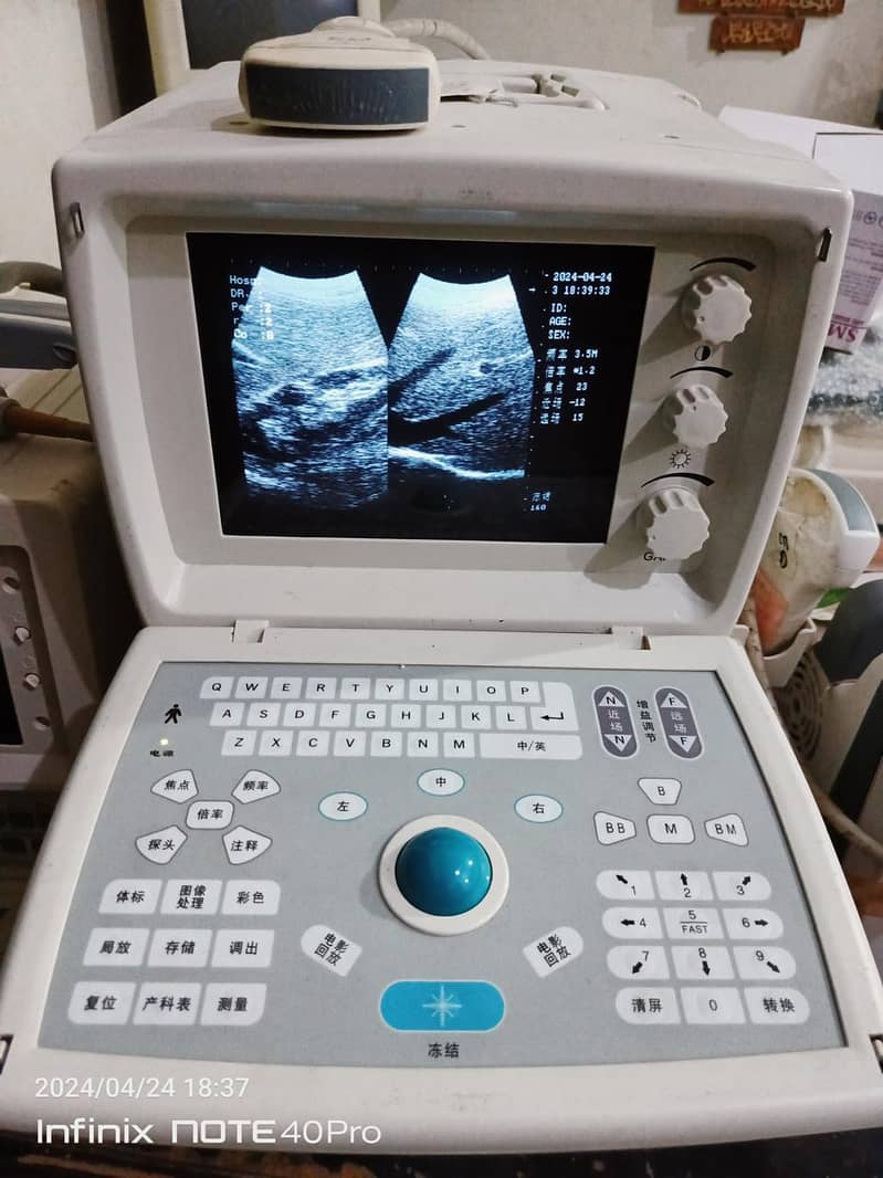 Ultrasound machines & Thermal Paper Rolls  etc 1