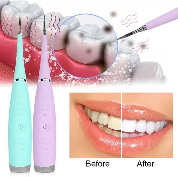 Ultrasonic Teeth Cleaner 12