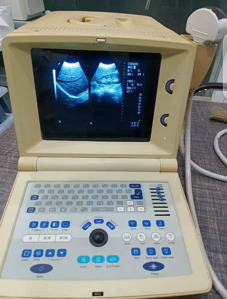 portable ultrasound machine available 18