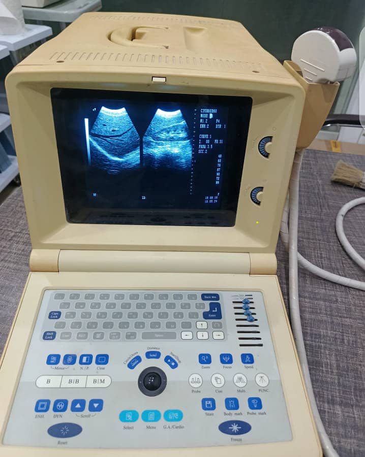 portable ultrasound machine for sale, contact; 0302-5698121 6