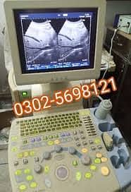 portable ultrasound machine for sale, contact; 0302-5698121 19