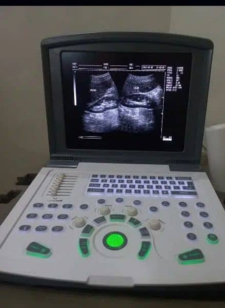 NOVADEX DIGITAL BATTERY OPRATED ULTRASOUND MACHINE 7