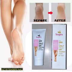feet healing cream