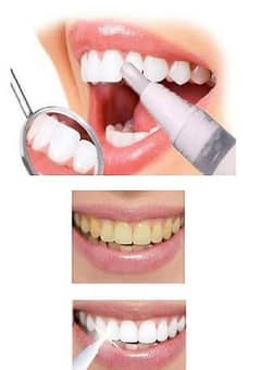 Teeth Whitening Pen, Removes