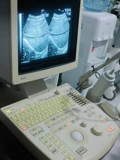 Ultrasound Machine Aloka 10000