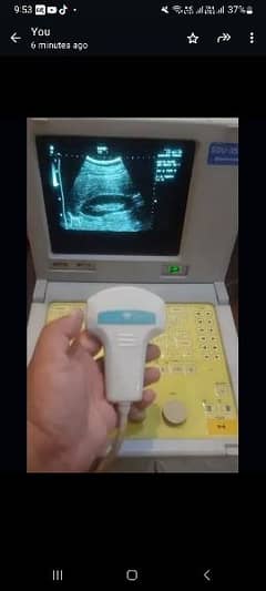ultrasound machine. .
