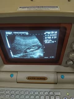 kaixin Kx 2000G ultrasound machine