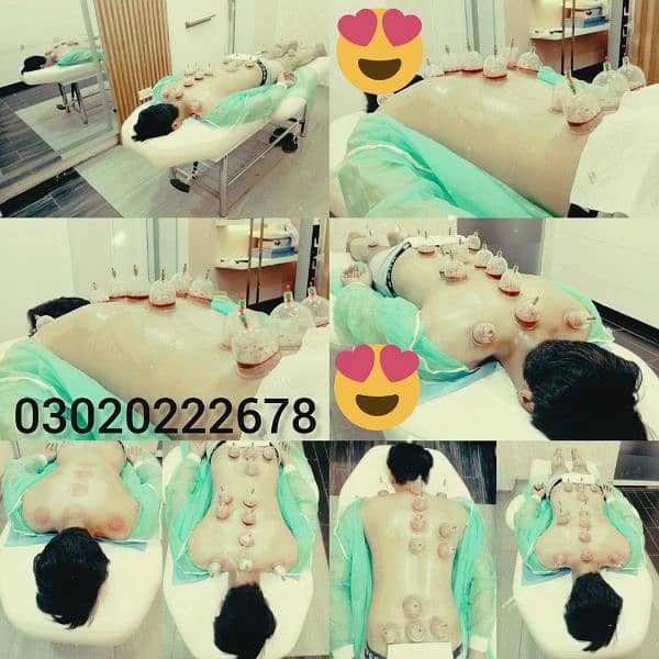 Rosmatic Hijama Cupping Therapy Medication Center  Hospital Clinic Gym 8