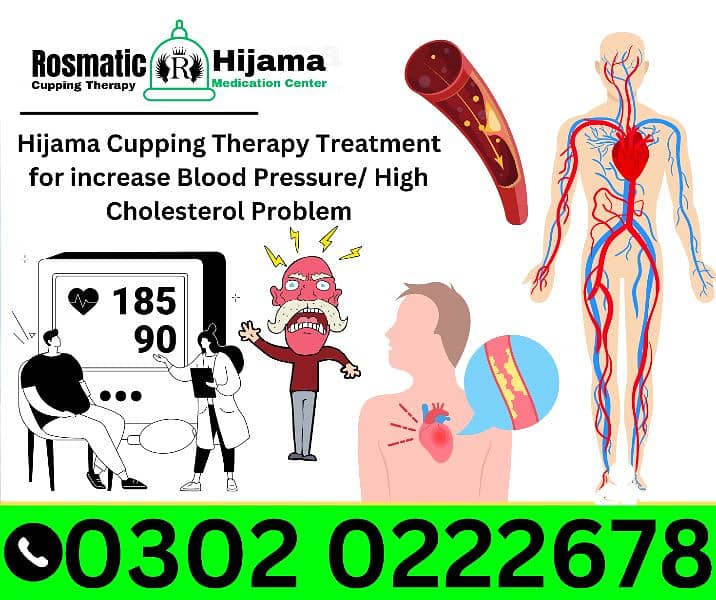 Rosmatic Hijama Cupping Therapy Medication Center  Hospital Clinic Gym 14