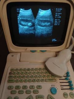 CHINA USED A CLASS ULTRASOUND MACHINES IN BULCK RATE