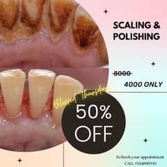 Scaling and Polishing of teeth 50% OFF
