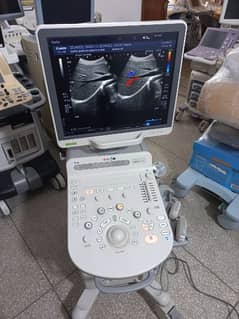 ultrasound machine O3325OO8691