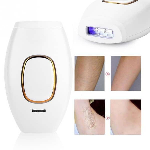 IPL LASER Hair Removal 1