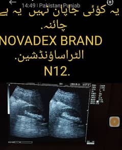 NOVADEX N12 NOTE BOOK DIGITAL ULTRASOUND MACHINE