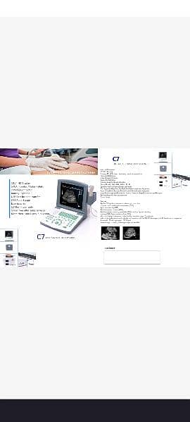 NOVADEX C7 DIGITAL ULTRASOUND MACHINE ON INSTALLMENT. OFFER 2