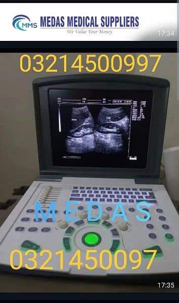 Novadex c7 digital battery oprated ultrasound machine installment pr l 4